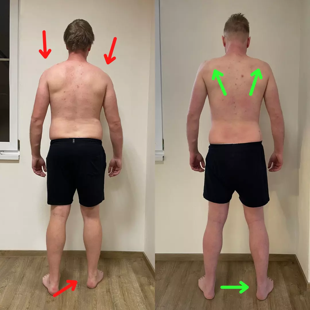 results-filip-3-months-back-view