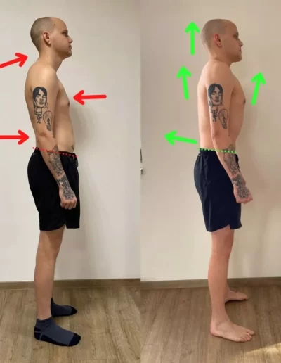 results-ondra-2-months-right-view