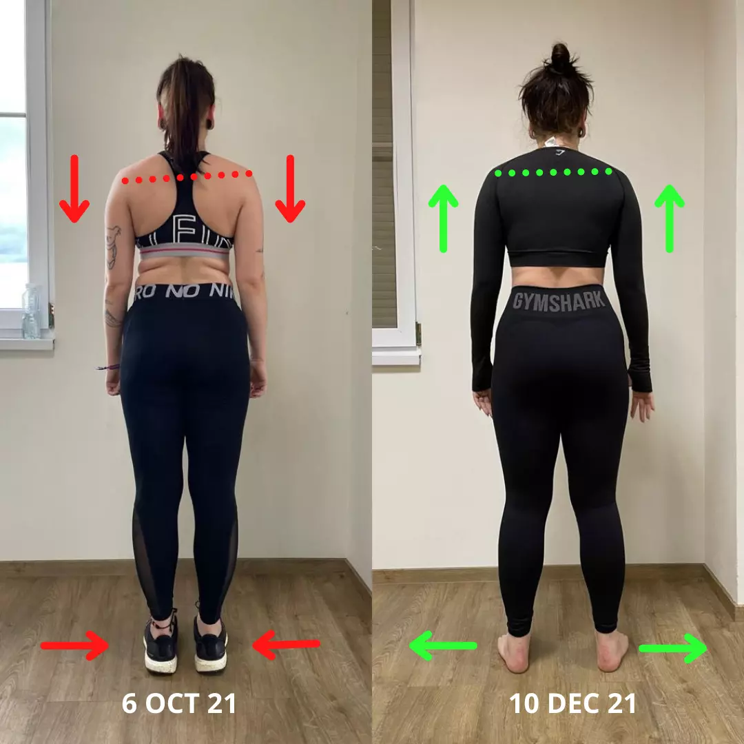 results-veronika-2-months-back-view