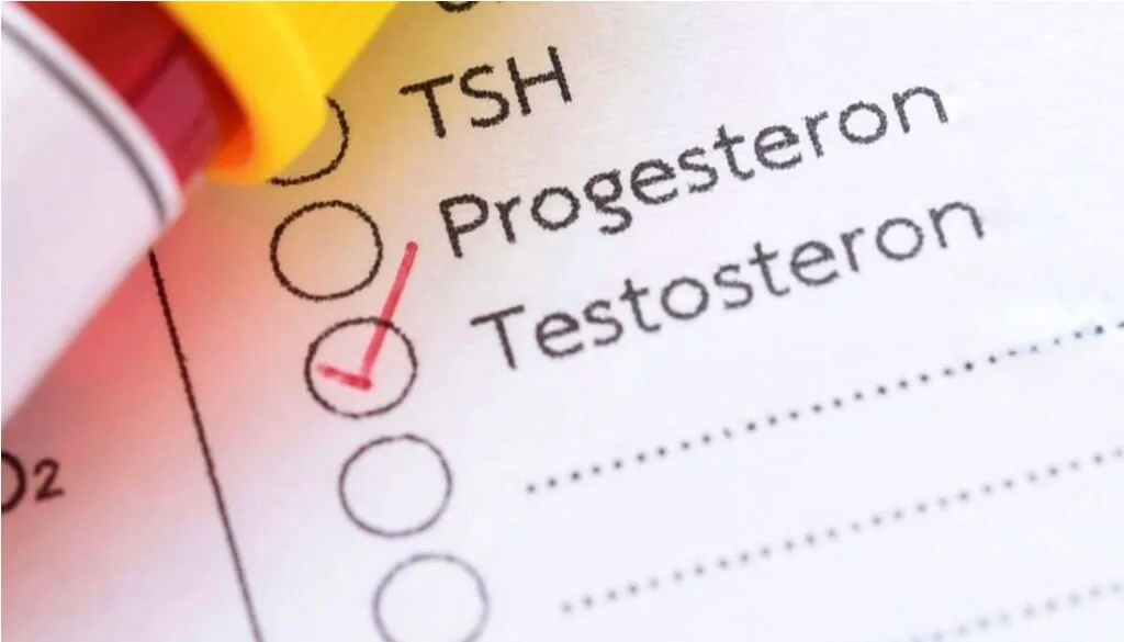testosterone-blood-test 